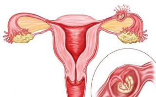 Apakah ada kemungkinan hamil setelah kehamilan ektopik?